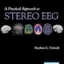 A Practical Approach to Stereo EEG