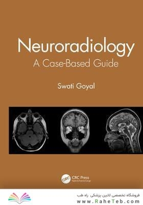 Neuroradiology : A Case-Based Guide