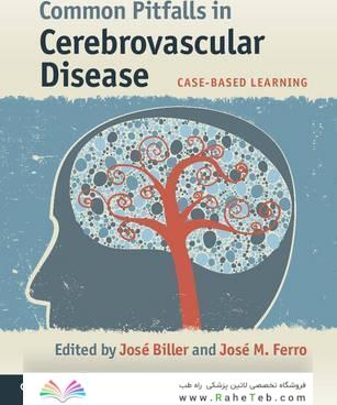 Common Pitfalls in Cerebrovascular Disease: Case-Based Learning