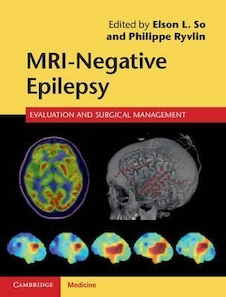 عکس MRI-Negative Epilepsy: Evaluation and Surgical Management