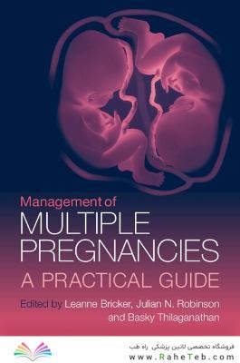 Management of Multiple Pregnancies: A Practical Guide