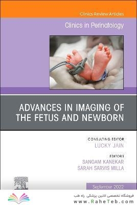 Advances in Neuroimaging of the Fetus and Newborn, An Issue of Clinics in Perinatology