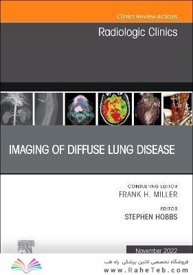 Imaging of Diffuse Lung Disease, An Issue of Radiologic Clinics of North America