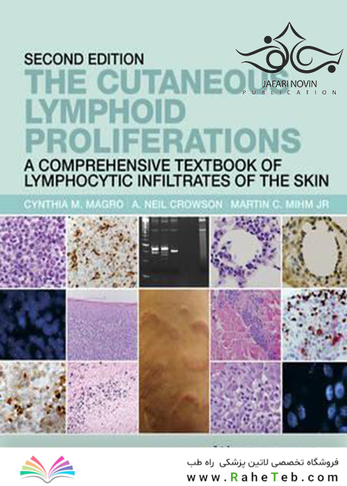 The Cutaneous Lymphoid Proliferations: A Comprehensive Textbook of Lymphocytic Infiltrates of the Skin 2nd Edition, Kindle Edition