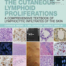 The Cutaneous Lymphoid Proliferations: A Comprehensive Textbook of Lymphocytic Infiltrates of the Skin 2nd Edition, Kindle Edition
