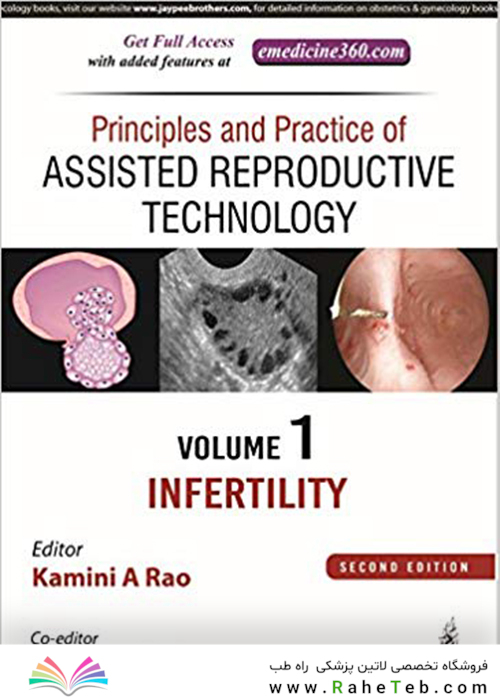 Principles and Practice of Assisted Reproductive Technology : Three Volume Set 2018