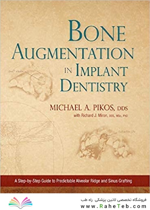 Bone Augmentation in Implant Dentistry: A Step-by-Step Guide to Predictable Alveolar Ridge and Sinus Grafting 1st Edition 2019