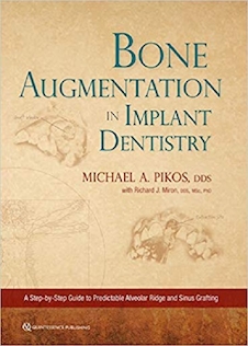 عکس Bone Augmentation in Implant Dentistry: A Step-by-Step Guide to Predictable Alveolar Ridge and Sinus Grafting 1st Edition 2019