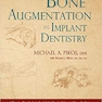 Bone Augmentation in Implant Dentistry: A Step-by-Step Guide to Predictable Alveolar Ridge and Sinus Grafting 1st Edition 2019