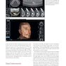 Bone Augmentation in Implant Dentistry: A Step-by-Step Guide to Predictable Alveolar Ridge and Sinus Grafting 1st Edition 2019