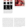 Bone Augmentation in Implant Dentistry: A Step-by-Step Guide to Predictable Alveolar Ridge and Sinus Grafting 1st Edition 2019