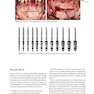 Bone Augmentation in Implant Dentistry: A Step-by-Step Guide to Predictable Alveolar Ridge and Sinus Grafting 1st Edition 2019