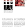 Bone Augmentation in Implant Dentistry: A Step-by-Step Guide to Predictable Alveolar Ridge and Sinus Grafting 1st Edition 2019