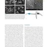 Bone Augmentation in Implant Dentistry: A Step-by-Step Guide to Predictable Alveolar Ridge and Sinus Grafting 1st Edition 2019