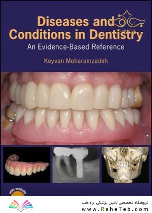 Diseases and Conditions in Dentistry: An Evidence-Based Reference 1st Edition 2018  بیماریها و شرایط در دندانپزشکی: یک مرجع مبتنی بر شواهد