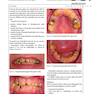 Diseases and Conditions in Dentistry: An Evidence-Based Reference 1st Edition 2018  بیماریها و شرایط در دندانپزشکی: یک مرجع مبتنی بر شواهد