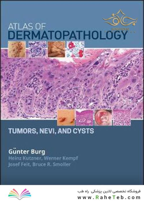   Atlas of Dermatopathology: Tumors, Nevi, and Cysts 1st Edition, Kindle Edition 2019 اطلس پوست : تومورها ، نووی و کیست 