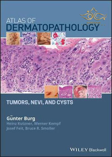عکس   Atlas of Dermatopathology: Tumors, Nevi, and Cysts 1st Edition, Kindle Edition 2019 اطلس پوست : تومورها ، نووی و کیست 