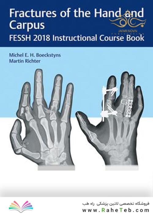 Fractures of the Hand and Carpus: FESSH 2018 Instructional Course Book 1st Edition