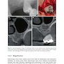  Advances in Periodontal Surgery: A Clinical Guide to Techniques and Interdisciplinary Approaches 1st ed. 2020 Edition پیشرفت در جراحی پریودنتال: راهنمای بالینی تکنیک ها و رویکردهای بین رشته ای