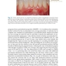  Advances in Periodontal Surgery: A Clinical Guide to Techniques and Interdisciplinary Approaches 1st ed. 2020 Edition پیشرفت در جراحی پریودنتال: راهنمای بالینی تکنیک ها و رویکردهای بین رشته ای