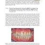  Advances in Periodontal Surgery: A Clinical Guide to Techniques and Interdisciplinary Approaches 1st ed. 2020 Edition پیشرفت در جراحی پریودنتال: راهنمای بالینی تکنیک ها و رویکردهای بین رشته ای