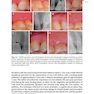  Advances in Periodontal Surgery: A Clinical Guide to Techniques and Interdisciplinary Approaches 1st ed. 2020 Edition پیشرفت در جراحی پریودنتال: راهنمای بالینی تکنیک ها و رویکردهای بین رشته ای