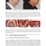  Orthodontics in Obstructive Sleep Apnea Patients: A Guide to Diagnosis, Treatment Planning, and Interventions 1st ed. 2020 Edition ارتودنسی در بیماران انسداد انسداد خواب: راهنمای تشخیص ، برنامه ریزی درمانی و مداخلات