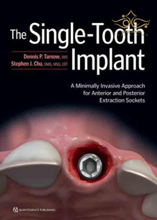 عکس The Single-Tooth Implant: A Minimally Invasive Approach for Anterior and Posterior Extraction Sockets 1st Edition 2020