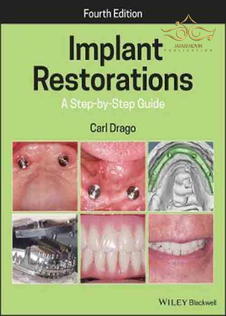 عکس  Implant Restorations: A Step-by-Step Guide 4th Edition, Kindle Edition 2020 ترمیم ایمپلنت: راهنمای گام به گام
