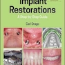 Implant Restorations: A Step-by-Step Guide 4th Edition, Kindle Edition 2020 ترمیم ایمپلنت: راهنمای گام به گام