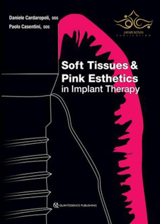 عکس Soft Tissues and Pink Esthetics in Implant Therapy 1st Edition 2020 بافت نرم و زیبایی زیبایی صورتی در درمان ایمپلنت