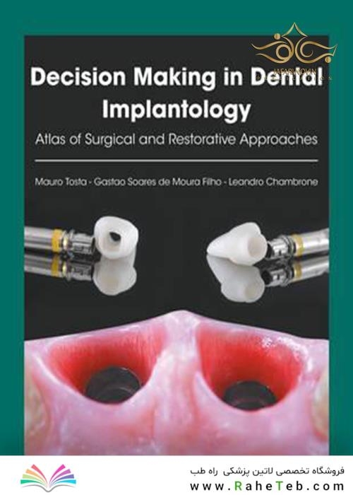 Decision Making in Dental Implantology: Atlas of Surgical and Restorative Approaches 1st Edition, Kindle Edition 2018 تصمیم گیری در ایمپلنتولوژی دندانپزشکی: اطلس رویکردهای جراحی و ترمیمی