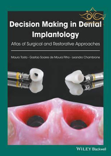 عکس Decision Making in Dental Implantology: Atlas of Surgical and Restorative Approaches 1st Edition, Kindle Edition 2018 تصمیم گیری در ایمپلنتولوژی دندانپزشکی: اطلس رویکردهای جراحی و ترمیمی