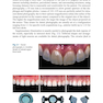 Digital Restorative Dentistry: A Guide to Materials, Equipment, and Clinical Procedures 1st ed. 2019 Edition