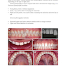 Digital Restorative Dentistry: A Guide to Materials, Equipment, and Clinical Procedures 1st ed. 2019 Edition