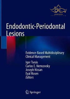 عکس Endodontic-Periodontal Lesions: Evidence-Based Multidisciplinary Clinical Management 1st ed. 2019 Edition, Kindle Edition ضایعات اندودنتیک-پریودنتال