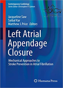 عکس Left Atrial Appendage Closure: Mechanical Approaches to Stroke Prevention in Atrial Fibrillation2016 بسته شدن زائده دهلیز چپ: رویکردهای مکانیکی پیشگیری از سکته مغزی در فیبریلاسیون دهلیزی