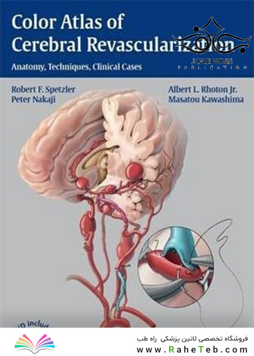 Color Atlas of Cerebral Revascularization: Anatomy, Techniques, Clinical Cases2013 اطلس رنگی عروق مغزی: آناتومی ، تکنیک ها ، موارد بالینی