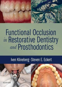 عکس Functional Occlusion in Restorative Dentistry and Prosthodontics2015 انسداد عملکردی در دندانپزشکی ترمیمی و پروتزهای دندانی