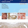 Burghardt’s Primary Care Colposcopy Textbook and Atlas, 2th Edition2017 اطلس کولپوسکوپی مراقبت های اولیه
