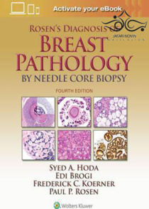 عکس Rosen’s Diagnosis of Breast Pathology by Needle Core Biopsy 4th Edition2017 تشخیص پاتولوژی پستان توسط بیوپسی هسته سوزنی