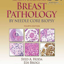 Rosen’s Diagnosis of Breast Pathology by Needle Core Biopsy 4th Edition2017 تشخیص پاتولوژی پستان توسط بیوپسی هسته سوزنی