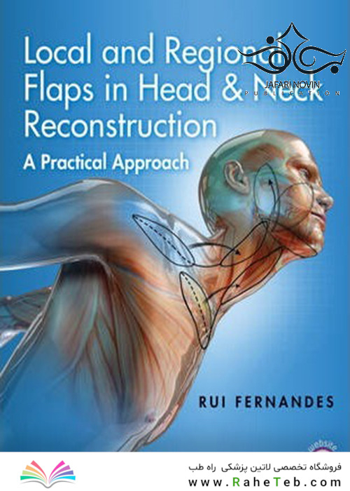Local and Regional Flaps in Head and Neck Reconstruction2017
