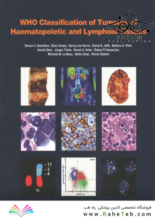 WHO Classification of Tumours of Haematopoietic and Lymphoid Tissues2017