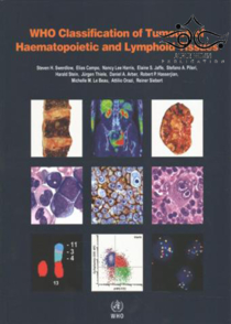 عکس WHO Classification of Tumours of Haematopoietic and Lymphoid Tissues2017