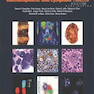 WHO Classification of Tumours of Haematopoietic and Lymphoid Tissues2017