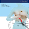Breast Cancer: Diagnostic Imaging and Therapeutic Guidance2017 سرطان پستان: تصویربرداری تشخیصی و راهنمایی درمانی
