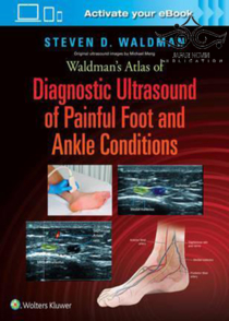 عکس Waldman’s Atlas of Diagnostic Ultrasound of Painful Foot and Ankle Conditions2016 اطلس سونوگرافی تشخیصی از شرایط دردناک مچ پا