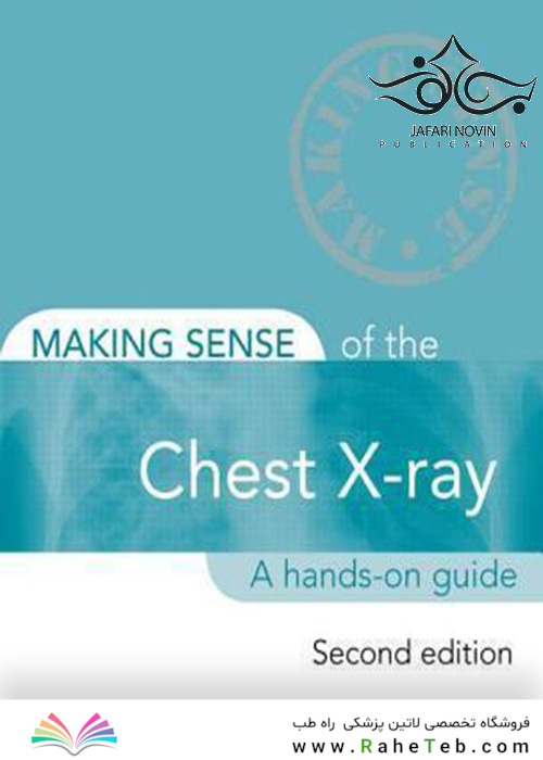 Making Sense of the Chest X-ray: A hands-on guide, 2nd Edition2013 ساختن حس اشعه ایکس قفسه سینه: یک راهنمای عملی